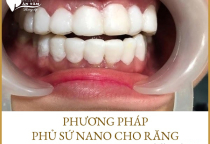 PHỦ SỨ NANO VÀ NHỮNG TÁC HẠI KHÔNG NGỜ ĐẾN PHỦ SỨ NANO VÀ NHỮNG TÁC HẠI KHÔNG NGỜ ĐẾN