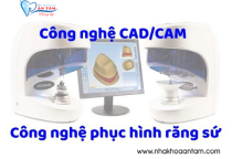 KỸ THUẬT CAD/CAM TRONG NHA KHOA LÀ GÌ? KỸ THUẬT CAD/CAM TRONG NHA KHOA LÀ GÌ?
