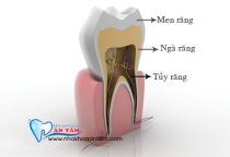TÌM HIỂU VỀ MEN RĂNG TÌM HIỂU VỀ MEN RĂNG