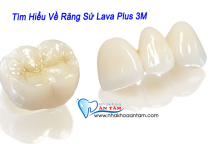 RĂNG SỨ LAVA CỦA NƯỚC NÀO? CÓ MẤY LOẠI? ƯU NHƯỢC ĐIỂM RA SAO? RĂNG SỨ LAVA CỦA NƯỚC NÀO? CÓ MẤY LOẠI? ƯU NHƯỢC ĐIỂM RA SAO?