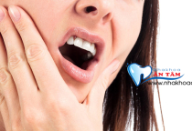 RĂNG BỊ Ê BUỐT THÌ PHẢI LÀM SAO? RĂNG BỊ Ê BUỐT THÌ PHẢI LÀM SAO?