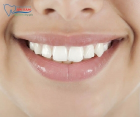 NHA KHOA BẢO TỒN - RĂNG KHỂNH LÀ GÌ?