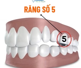 NHA KHOA BẢO TỒN - RĂNG SỐ 5 LÀ RĂNG NÀO? MẤT RĂNG SỐ 5 CÓ SAO KHÔNG?