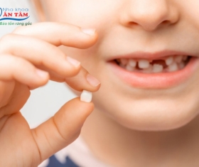 NHA KHOA BẢO TỒN - KHI NÀO NÊN NHỔ RĂNG SỮA CHO TRẺ EM? CÁCH NHỔ AN TOÀN