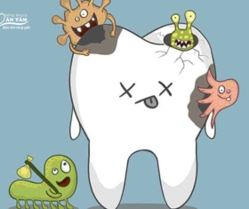 NHA KHOA BẢO TỒN - VI KHUẨN SÂU RĂNG - NHỮNG ĐIỀU CẦN BIẾT ĐỂ BẢO VỆ RĂNG MIỆNG