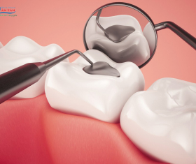 NHA KHOA BẢO TỒN - TRÁM RĂNG CÓ ĐAU KHÔNG?