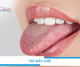 NHA KHOA BẢO TỒN - HẬU QUẢ CỦA TẬT ĐẨY LƯỠI