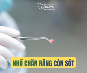 NHA KHOA BẢO TỒN - NHỔ RĂNG CÒN SÓT CHÂN RĂNG DO ĐÂU?