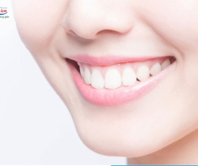 NHA KHOA BẢO TỒN - NHỮNG CẢM GIÁC SAU KHI BỌC RĂNG SỨ THƯỜNG GẶP NHẤT