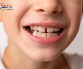NHA KHOA BẢO TỒN - KHÔNG CÓ MẦM RĂNG VĨNH VIỄN CÓ SAO KHÔNG?