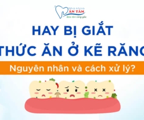 NHA KHOA BẢO TỒN - GIẮT THỨC Ở KẼ RĂNG: NGUYÊN NHÂN VÀ CÁCH KHẮC PHỤC HIỆU QUẢ