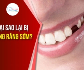 NHA KHOA BẢO TỒN - NGUYÊN NHÂN RỤNG RĂNG SỚM VÀ NHỮNG TÁC HẠI ĐÁNG SỢ