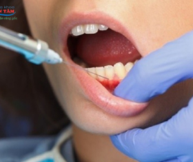 NHA KHOA BẢO TỒN - THUỐC TÊ TRONG NHA KHOA LÀ GÌ?