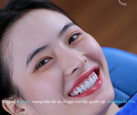 NHA KHOA BẢO TỒN - RĂNG SỨ LAVA CÓ GÌ ĐẶC BIỆT