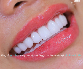 NHA KHOA BẢO TỒN - KHI NÀO CẦN THAY RĂNG SỨ? 