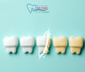 NHA KHOA BẢO TỒN - NGUYÊN NHÂN KHIẾN RĂNG BỊ XỈN MÀU