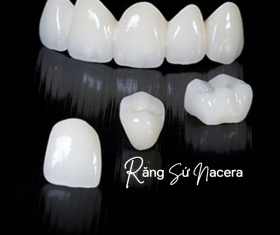 RĂNG SỨ NACERA CÓ TỐT KHÔNG?