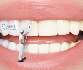 NHA KHOA BẢO TỒN - TẨY TRẮNG RĂNG GIỮ ĐƯỢC BAO LÂU?