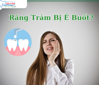 NHA KHOA BẢO TỒN - TRÁM RĂNG XONG BỊ Ê BUỐT DO ĐÂU?