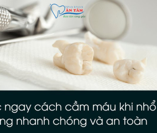 NHA KHOA BẢO TỒN - NHỮNG CÁCH CẦM MÁU SAU KHI NHỔ RĂNG HIỆU QUẢ