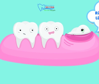 NHA KHOA BẢO TỒN - RĂNG KHÔN MỌC Ở ĐÂU VÀ DẤU HIỆU