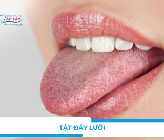 NHA KHOA BẢO TỒN - HẬU QUẢ CỦA TẬT ĐẨY LƯỠI