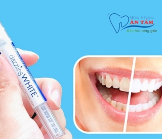 NHA KHOA BẢO TỒN - BÚT TẨY TRẮNG RĂNG LÀ GÌ?