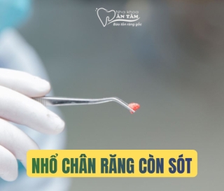 NHA KHOA BẢO TỒN - NHỔ RĂNG CÒN SÓT CHÂN RĂNG DO ĐÂU?