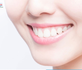 NHA KHOA BẢO TỒN - NHỮNG CẢM GIÁC SAU KHI BỌC RĂNG SỨ THƯỜNG GẶP NHẤT