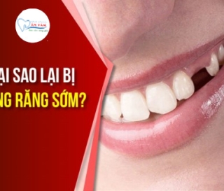 NHA KHOA BẢO TỒN - NGUYÊN NHÂN RỤNG RĂNG SỚM VÀ NHỮNG TÁC HẠI ĐÁNG SỢ