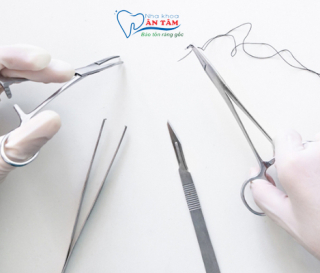 NHA KHOA BẢO TỒN - CHỈ KHÂU TỰ TIÊU LÀ GÌ?