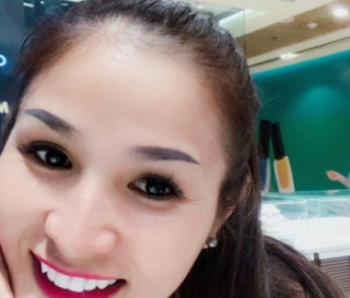 BẬT MÍ NHỎ 4 MẸO CHỮA TỤT LỢI CHÂN RĂNG 