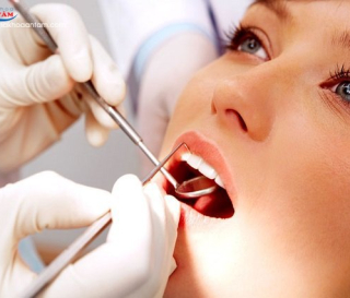 CẦN CHĂM SÓC RĂNG THẾ NÀO SAU KHI DÁN SỨ VENEER?