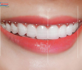 THẾ NÀO LÀ HÀM RĂNG ĐẸP CHUẨN Y KHOA?