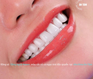 GIẢI PHÁP BẢO TỒN RĂNG THẬT TỐI ĐA TẠI NHA KHOA ÂN TÂM