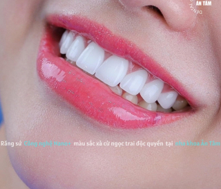 NHA KHOA BẢO TỒN - CUNG RĂNG LÀ GÌ?