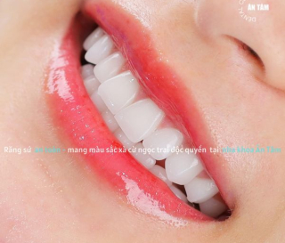 NHA KHOA BẢO TỒN - BỌC RĂNG SỨ BAO LÂU THÌ ĂN ĐƯỢC?