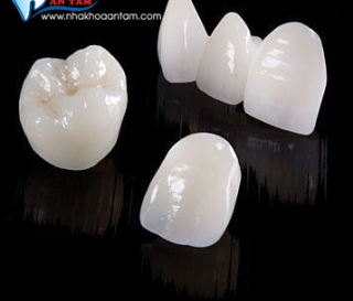 MÃO RĂNG SỨ LÀ GÌ?