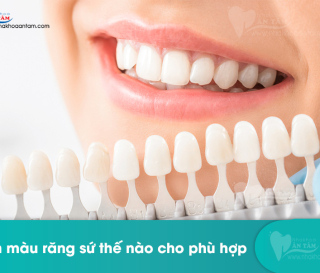 CÁCH CHỌN MÀU RĂNG SỨ THẾ NÀO PHÙ HỢP.