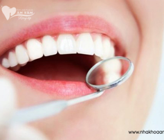 LÀM RĂNG SỨ CẦN CHÚ Ý NHỮNG GÌ?