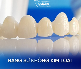 NHA KHOA BẢO TỒN - RĂNG SỨ KHÔNG KIM LOẠI LÀ GÌ?