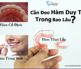 HÀM DUY TRÌ LÀ GÌ?