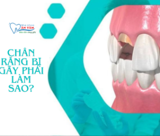 NHA KHOA BẢO TỒN - RĂNG BỊ GÃY CÒN CHÂN RĂNG PHẢI LÀM SAO?