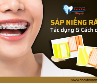 SỬ DỤNG SÁP CHỈNH NHA HIỆU QUẢ