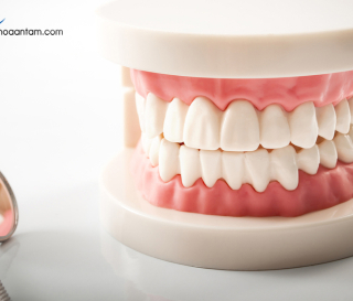 TRỒNG RĂNG GIẢ THÁO LẮP Ở ĐÂU UY TÍN?