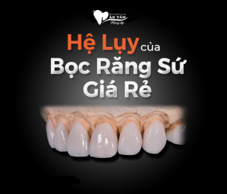 HẬU QUẢ BỌC RĂNG SỨ GIÁ RẺ?