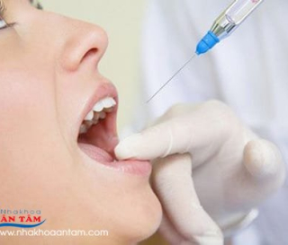 ĐIỀU TRỊ TỦY RĂNG CÓ ĐAU KHÔNG?