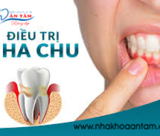 ĐIỀU TRỊ NHA CHU NHƯ THẾ NÀO?