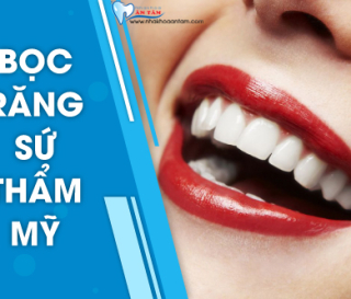 CÓ NÊN BỌC RĂNG SỨ THẨM MỸ KHÔNG?