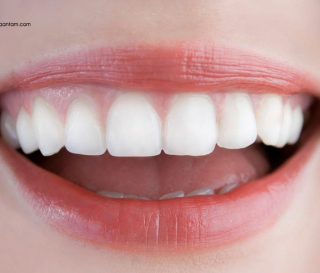 LỰA  CHỌN VẬT LIỆU SỨ CHO PHÙ HỢP BỆNH NHÂN